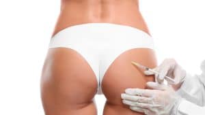 Frequently Asked Questions about Gluteal Harmonization