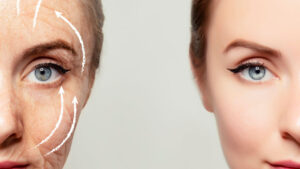 Armonización facial