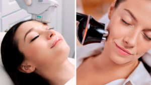 Ultherapy-vs-Trilift