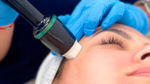 tratamientos faciales