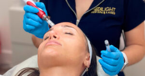 Descubre-tu-piel-antes-y-después