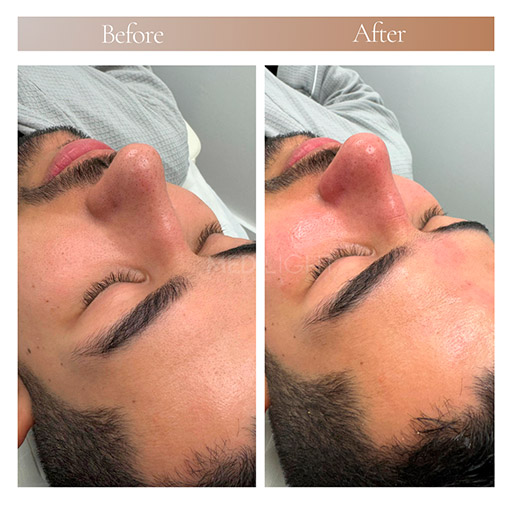 Signature Facial